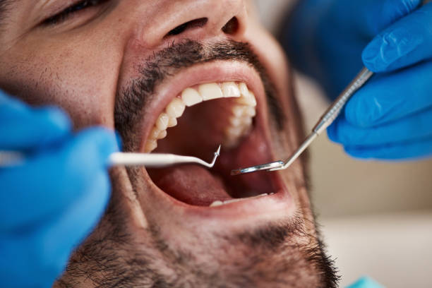 Best Tooth Pain Emergency Relief  in Bethany, OK